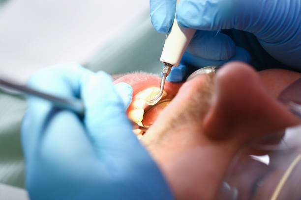 Best Pediatric Emergency Dentist in Millington, TN