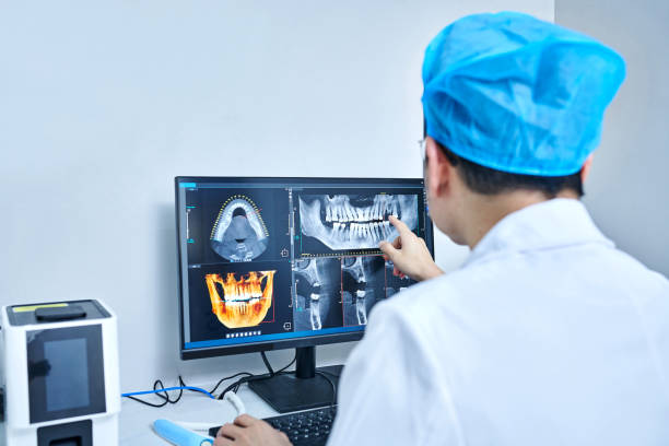 Best Emergency Tooth Extraction in Millington, TN